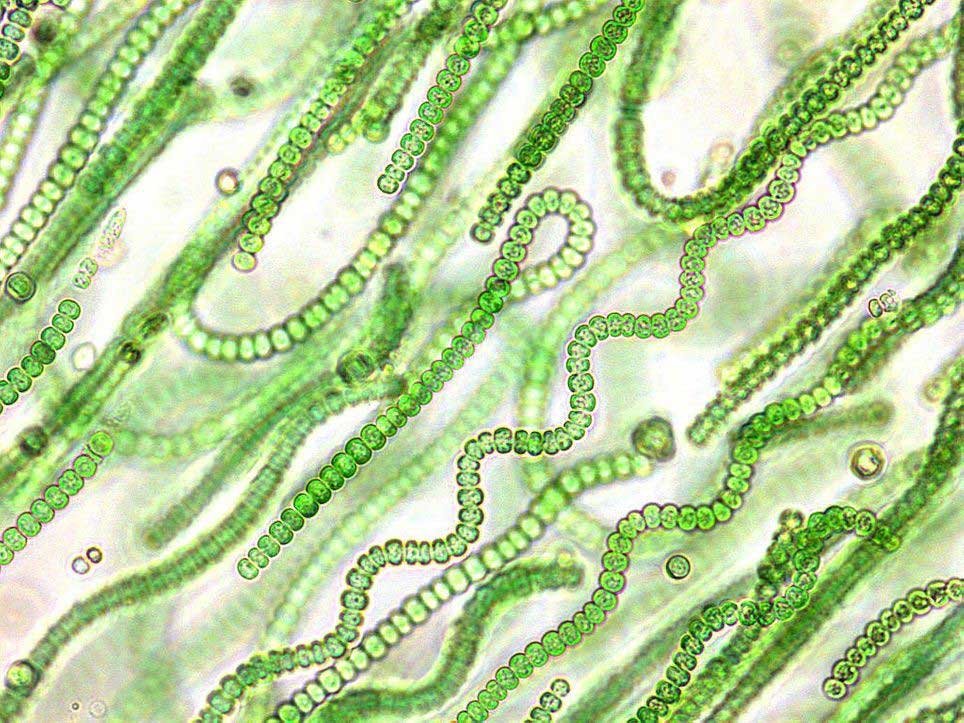 Cadenas de microalgas color verde