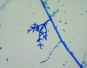 acuaponia - sistema de acuaponia