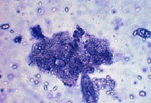 Biofloc - sistema biofloc