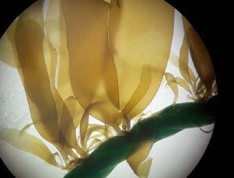 Esporofitos juveniles de alga parda