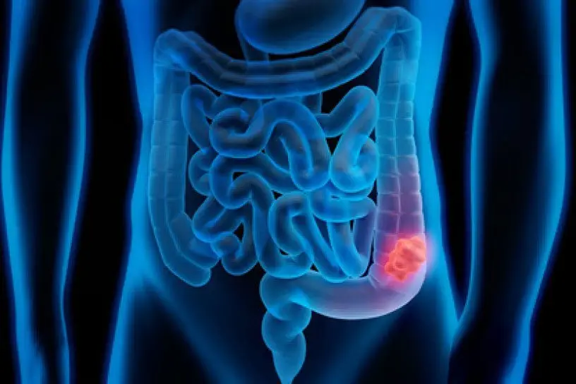 colon humano